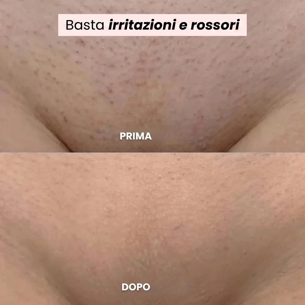 Kelya® – Il trimmer 2 in 1 per pelli sensibili